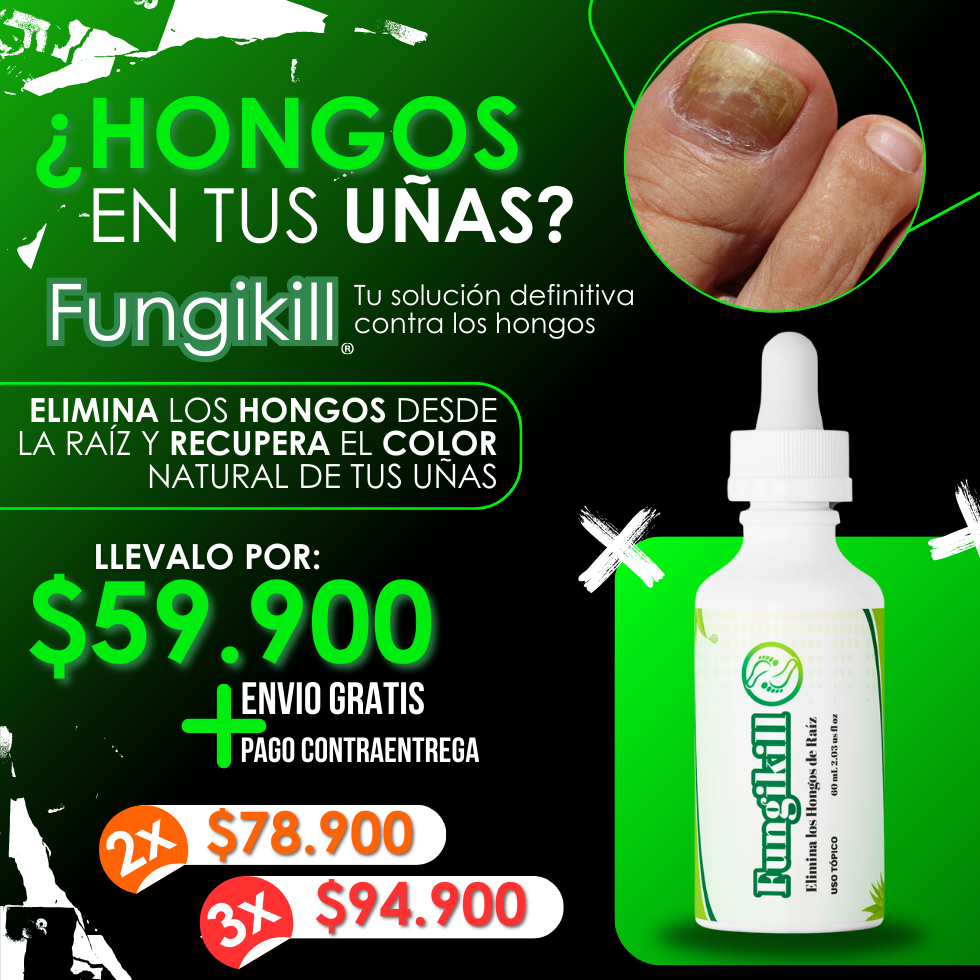 Fungikill® – Elimina los Hongos de Raíz y Recupera la Salud de tus Uñas
