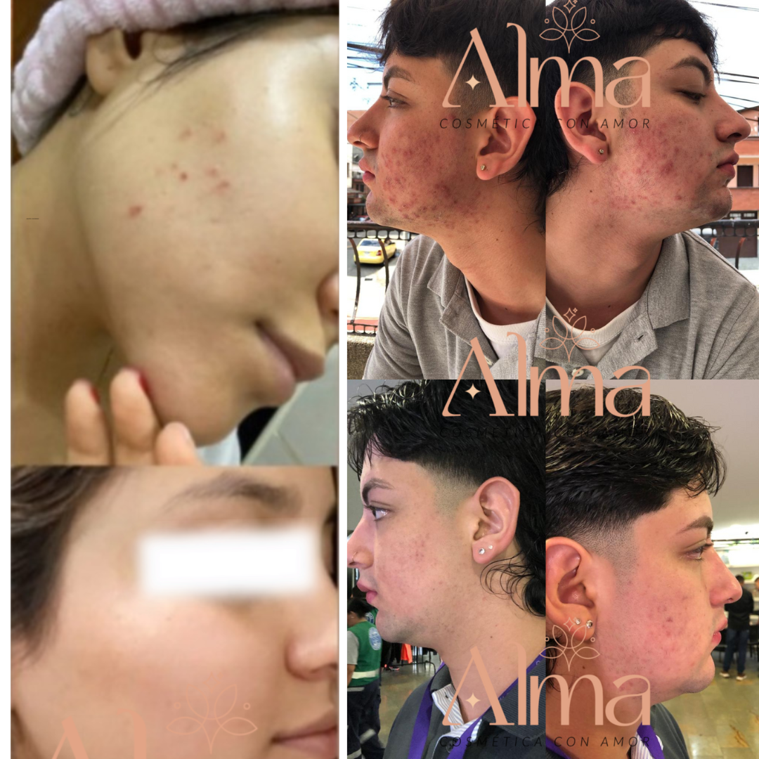 TÓNICO FACIAL DESPIGMENTANTE e iluminador Alma